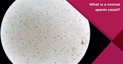 Normal Sperm Count: Understanding Your Semen Analysis .